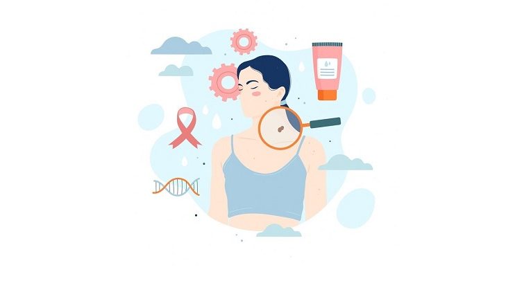 What Does the Beginning of Skin Cancer Feel Like?